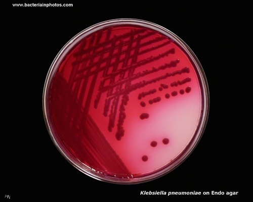 klebsiella colonies on Endo(lactose fermentation)